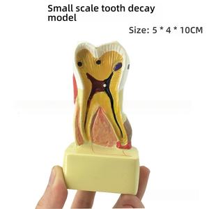 4X modèle de développement de caries dentaires en PVC agrandi pour l'éducation des patients et l'outil de formation dentaire - Product Image 3