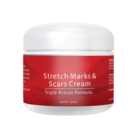 Crème anti-vergetures à la mangue la plus vendue, marque privée, réparation post-grossesse, cicatrices, ligne abdominale, vergetures, crème personnalisée