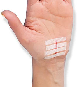 Kit di chiusura a ferita di emergenza <span class=keywords><strong>Steri</strong></span> <span class=keywords><strong>Strips</strong></span> riparazione lacerazione senza punti rapida ed efficace dispositivi di chiusura per sutura della ferita - Product Image 1