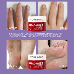 Crema per la Cura dei Piedi con 0,5% di Vitamina E e 20% di Urea, Idratante, Sbiancante, Rimuove la Pelle Morta, Ripara le Funzioni Fungine, Previene Secchezza e Screpolature - Product Image 4