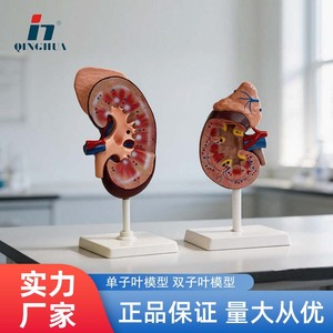 Modèle de rein humain ; anatomie du rein ; modèle agrandi de la glande surrénalette ; rein malade ; anatomie des organes internes humains. - Product Image 4