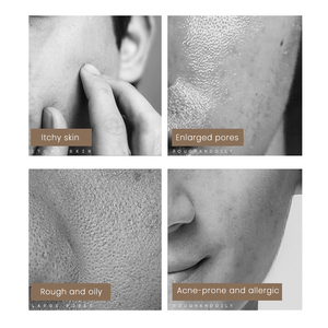 <span class=keywords><strong>Limpiador</strong></span> Facial MULAN Personalizado, Fórmula Refrescante para Combatir el Acné, Limpieza Profunda para Piel Sensible, <span class=keywords><strong>Limpiador</strong></span> de Poros - Product Image 2