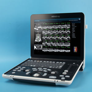 Ecógrafo Portátil <span class=keywords><strong>Mindray</strong></span> <span class=keywords><strong>DP</strong></span>-50 en Blanco y Negro para Uso Humano - Product Image 2