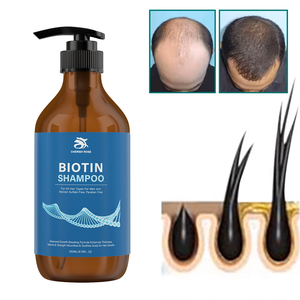 Etiqueta privada Crecimiento <span class=keywords><strong>del</strong></span> <span class=keywords><strong>cabello</strong></span> Calvo Mejor producto <span class=keywords><strong>para</strong></span> el crecimiento <span class=keywords><strong>del</strong></span> <span class=keywords><strong>cabello</strong></span> Bloqueador DHT Biotina Colágeno Champú <span class=keywords><strong>para</strong></span> <span class=keywords><strong>la</strong></span> pérdida de <span class=keywords><strong>cabello</strong></span> - Product Image 1