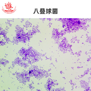 Cinco tipos de coxoides: comprensión preliminar de la morfología en la escuela de medicina; observación clara de bacterias microbianas - Product Image 4