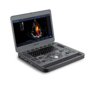 Ecógrafo Doppler Color Portátil Sonoscape X5 X5V, Nuevo y Más Vendido, con la Mejor Calidad para Veterinarios y Humanos - Product Image 1