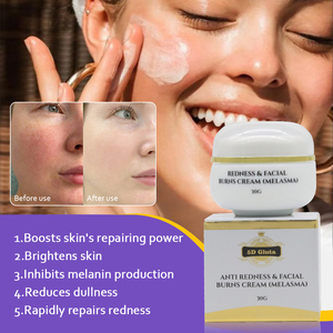 La <span class=keywords><strong>Mejor</strong></span> Crema para Eliminar el <span class=keywords><strong>Melasma</strong></span>, Aclarar el Rostro, Blanquear, Eliminar Manchas Negras y Pigmentación - Product Image 4