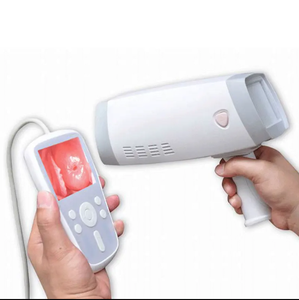 AMAIN Draagbare Digitale Video <span class=keywords><strong>Vagina</strong></span> Colposcoop Colposcopie Gynaecologisch Onderzoek - Product Image 1