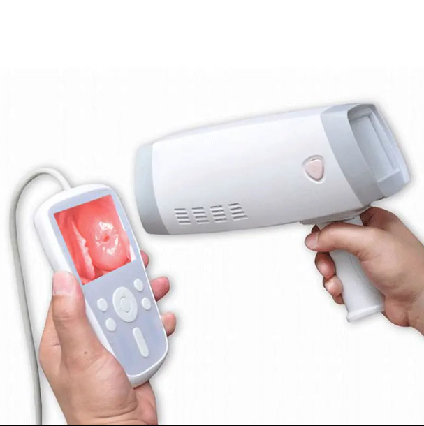 AMAIN Portable Digital Video Vagina Colposcope Colposcopy Gynecology Examination