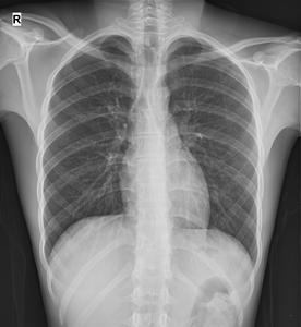 Detector de panel plano inalámbrico de 17x17 pulgadas de rayos <span class=keywords><strong>X</strong></span> médicos portátiles de radiación de dosis baja para clínica - Product Image 4