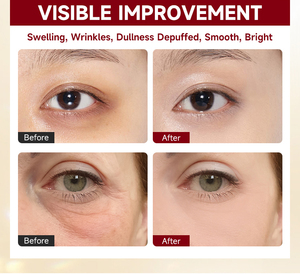 Parches de Hidrogel de Colágeno con Aceite para <span class=keywords><strong>Ojos</strong></span>, Tratamiento Reafirmante con Péptidos, Etiqueta Privada, Venta al por Mayor - Product Image 2