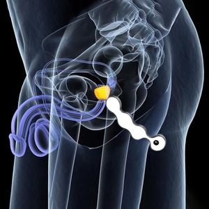 FRRK - Masajeador de Próstata con Bolas Anales BDSM para Hombres, Tapón Anal, Juguetes Sexuales, Estimulador de Orgasmos, Productos Pequeños para la Salud Sexual Íntima - Product Image 2