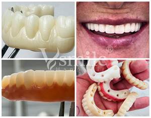 Blocchi di <span class=keywords><strong>Zirconia</strong></span> 3Dpro multistrato 98mm sistema aperto per laboratorio odontoiatrico CAD/CAM 16 colore e colore sbiancante - Product Image 4