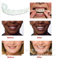 Snap Smile – Couvre-dents supérieurs et inférieurs personnalisés, facettes pour un sourire parfait, prothèses dentaires flexibles à ajustement confortable