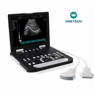 B53 giá thấp SONOSCAPE xách tay siêu âm DOPPLER Máy quét cho doanh số bán hàng - Product Image 1