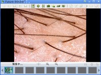 Microscope numérique portable 40X 240X à double alimentation pour soins personnels, analyseur de texture cutanée USB, étanche IP55, 8 LED