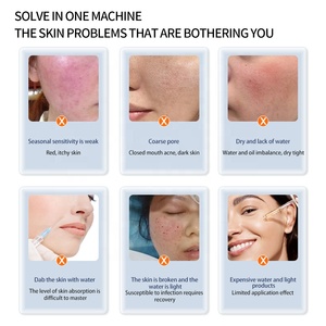 Producto de Belleza y Cuidado Personal en Oferta, Inyector Mesogun, Máquina de <span class=keywords><strong>Mesoterapia</strong></span> para Lifting Facial y Nasal <span class=keywords><strong>con</strong></span> Ácido Hialurónico - Product Image 6