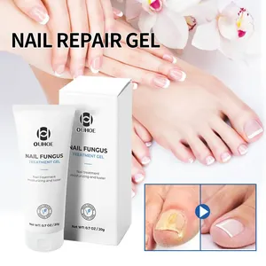 Crema antihongos para manos y pies, gel antihongos para eliminar hongos en las uñas, ungüento reparador de uñas para onicomicosis, 20g - Product Image 3
