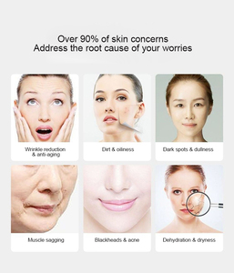 Máquina de Hidro-Oxígeno para Eliminar Arrugas y Blanquear la Piel, Máquina de Oxígeno Facial, Máquina de Dermoabrasión con Punta de Diamante para el Rostro - Product Image 5