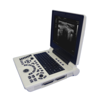Equipo Médico de Ultrasonido al Mejor Precio, Escáner de Ultrasonido Completamente Digital, Máquina de Ultrasonido Portátil en Blanco y Negro