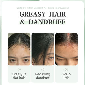 Barra de Champú Sólido con Aceite de Árbol de Té OEM para Cabello Graso - Limpieza Profunda del Cuero Cabelludo, Anticaspa, Sin Residuos, Fórmula Natural, Venta al Por Mayor - Product Image 4