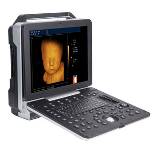 Mesin Ultrasound Laptop 4D Diagnosis Ultrasound, Instrumen Ultrasound <span class=keywords><strong>Doppler</strong></span> Warna Ultrasound - Product Image 2