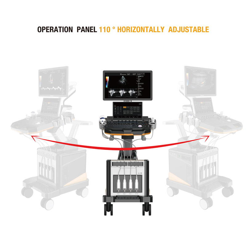 MN-Ultra8 Laptop Cart Ultrasonic Color Scanner Portable Ultrasonic Affordable Ultrasonic Scanner