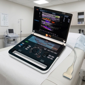 Offre Spéciale : Échographe <span class=keywords><strong>Doppler</strong></span> Couleur 3D/4D Portable – Appareil d'Échographie Hospitalière - Product Image 1
