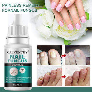 <span class=keywords><strong>Esmalte</strong></span> de <span class=keywords><strong>Uñas</strong></span> Natural y Seguro, Esencia Efectiva <span class=keywords><strong>para</strong></span> Reparar <span class=keywords><strong>Uñas</strong></span> Grises, Cuidado de la Piel, Solución Herbal contra <span class=keywords><strong>Hongos</strong></span>, 3 Años de Duración, Personalizable - Product Image 5