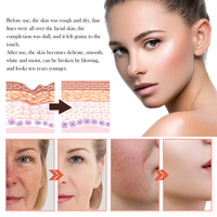 Sérum apaisant personnalisé pour le visage sensible Sérum à la vitamine C Soins du visage pour éclaircir la peau