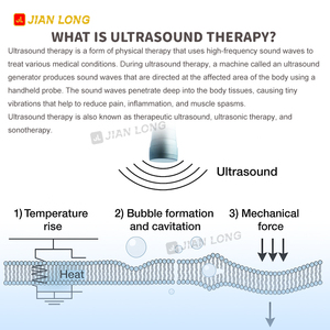 Appareil de physiothérapie à ultrasons à double canal Jianlong Ultrawave pour le soulagement de la douleur physique, les blessures des <span class=keywords><strong>tissus</strong></span> <span class=keywords><strong>mous</strong></span>, 1 MHz - Product Image 5