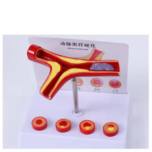 Model Pembelajaran arteri SCIEDU Model pengajaran sumber daya gray Anatomy manusia Model penyakit arteri koroner - Product Image 3