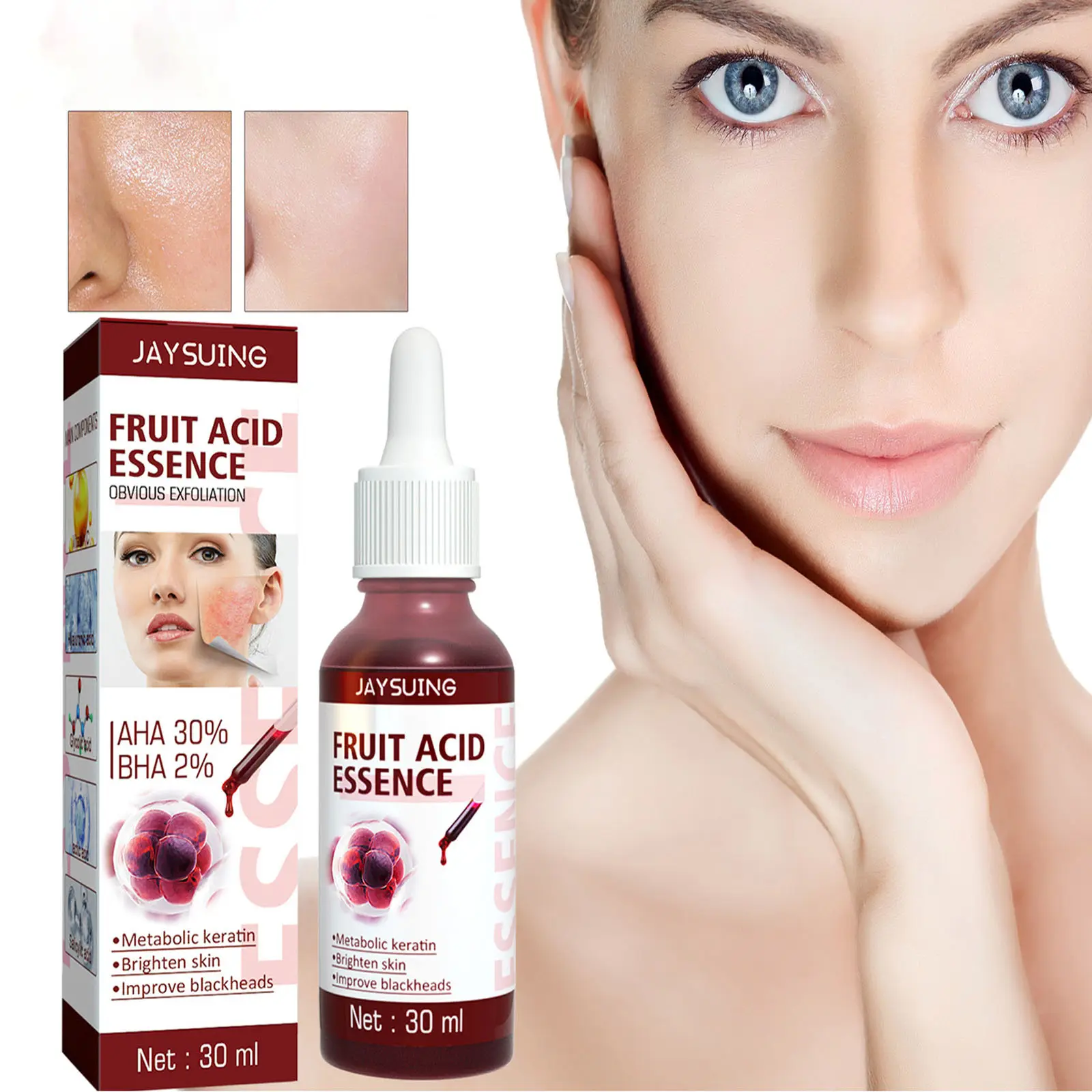 Fruit acid base solution to remove blackheads and acne, clean pores, soften cutin, brighten skin tone, repair essence