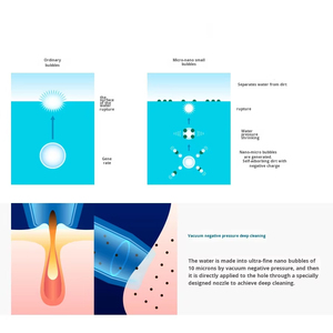Daily Care Large Bubble <strong>Multifunctional</strong> Skin Beauty Instrument Deep Cleansing Blackhead Removal Nutrient Infusion for SPA - Product Image 5