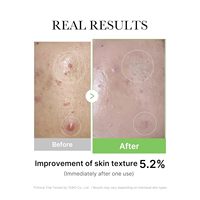 Ampoule Medicube Exosome Cica Tea Tree pour peaux sensibles avec sérum facial à la Centella Asiatica