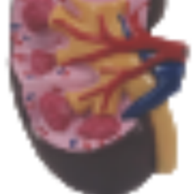 Modelo de anatomía renal ADA Medical Science con modelo de glándula suprarrenal U022C/U022D, origen Shanghái, para entrenamiento y demostración de enfermedades - Product Image 6