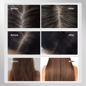 Set de Cuidado Capilar con Aceite de Argán Orgánico Natural Gatase, Hidratación Profunda, Reparación de Daños, Mejora el Brillo, para Cabello Seco y Encrespado, Uso Diario y en Salón - Product Image 4