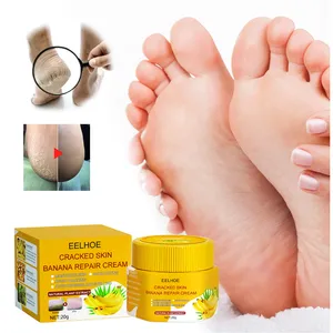 EELHOE cracked skin banana repair cream hand feet moisturizing heel cleft palate crack bleeding dry itches repairing cream