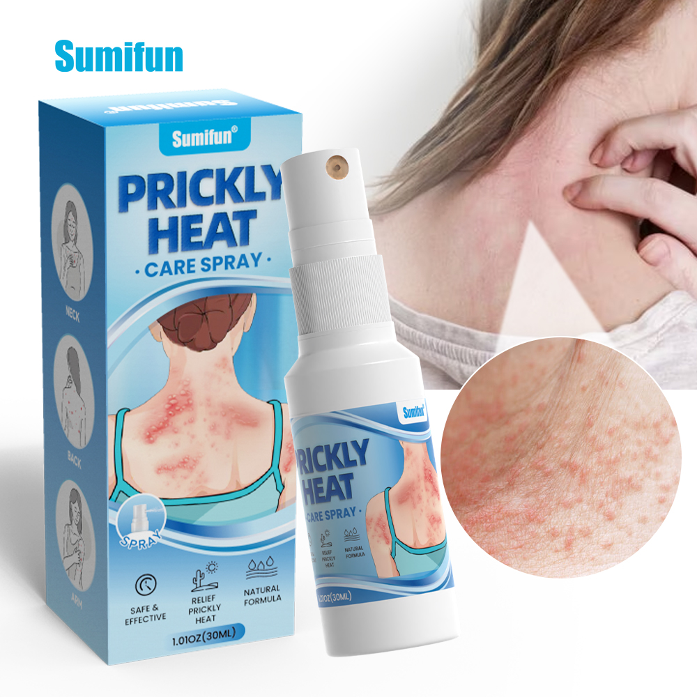 Sumifun Herbal Body Daily Care Sweet Floral Safety Spray 30mL for Prickly Heat Relief with 2 Year Shelf Life
