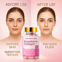 Complément alimentaire pour femmes adultes, blanchissant la peau, L-glutathion 5000 mg, gommes éclaircissantes pour la peau, anti-âge, antioxydant