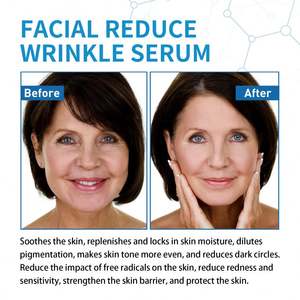 เจย์ซูอิง 30 มล. เซรั่มไฮยาลู บี5 ต่อต้านริ้วรอย ช่วยให้ความชุ่มชื้น ลดเลือนริ้วรอย บี5 ผลิตภัณฑ์บำรุงผิวหน้า เซรั่มน้ำมันบำรุงผิวหน้า ผสมไฮยาลูรอน - Product Image 6