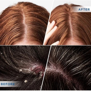 Bán buôn OEM/ODM caffeine dầu gội tóc chống ngứa thiệt hại sửa chữa nuôi dưỡng chăm sóc da đầu tốt nhất Biotin dầu gội đầu - Product Image 2