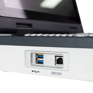 <span class=keywords><strong>15</strong></span> इंच एचडी डिस्प्ले 3 डी पोर्टेबल मशीन रंग डॉपलर अल्ट्रासाउंड स्कैनर रंग डोप्लर अल्ट्रासाउंड - Product Image 3