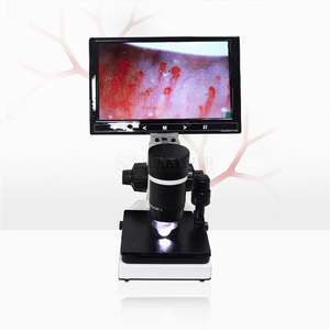 Capillaroscope vidéo de <span class=keywords><strong>microscope</strong></span> capillaire biologique à prix SY-B198 bon marché pour la clinique - Product Image 4