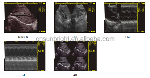 Multi Frequency Linear&convex Rectal Probe Vet Ultrasound Scanner Portable Handheld Veterinary Ultrasound Equipment