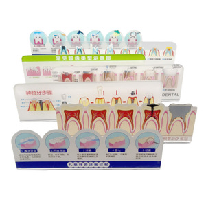 Model tampilan klinik gigi untuk menunjukkan penyakit periodalat-alat dan komunikasi antar gigi dalam renovasi mulut - Product Image 1