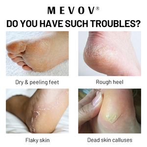Crème pour les pieds anti-callosités extra forte à étiquette privée, gel anti-callosités, lime à pieds avec outils de pédicure, fournitures, kit de <span class=keywords><strong>spa</strong></span> - Product Image 3