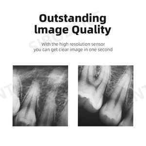 Capteur intra-oral dentaire RVG pour le traitement des implants et des canaux radiculaires - Product Image 5