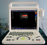 Machine de diagnostic par ultrasons Doppler couleur pour ordinateur portable E60