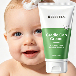 Crema Reparadora OEM/ODM, Fórmula Suave No Irritante, Elimina las Escamas, Alivio Seguro para el Cuidado Diario del Cuerpo de Recién Nacidos, Crema para la Capilaria - Product Image 1